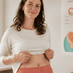 diastasis avant apres ventre femme cicatrice